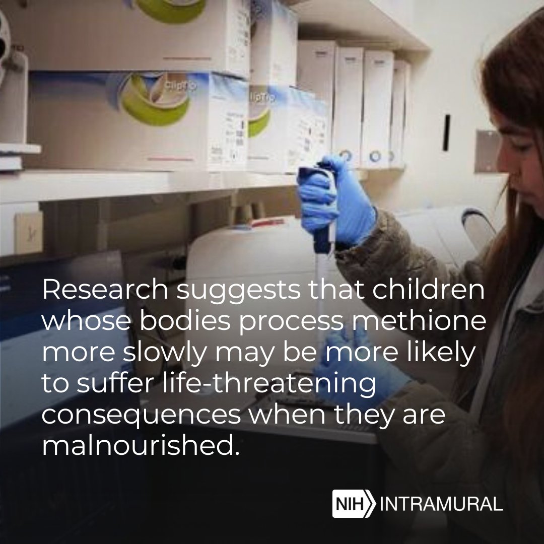 Dr. Neil Hanchard at @genome_gov hopes to improve the health of children experiencing #malnutrition by figuring out why some of them develop a life-threatening form of malnutrition called #kwashiorkor while others come down with a less immediately dangerous condition called