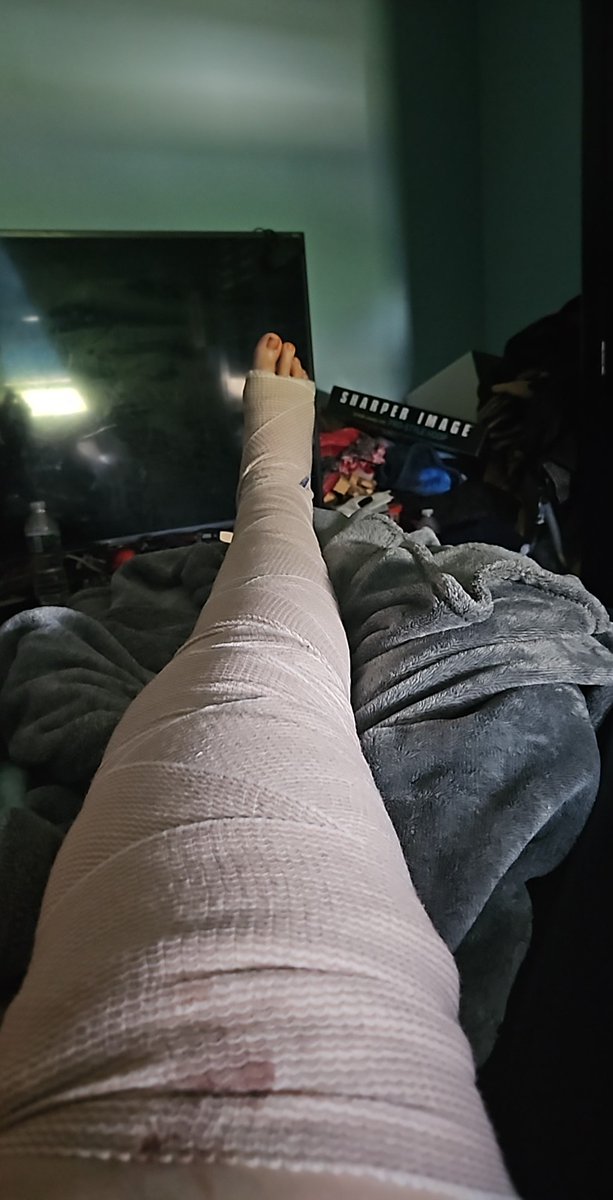 and so it begins!!   hopefully they aren't wrong about the healing process!!