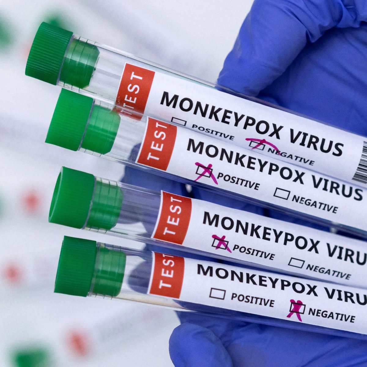 🚨BREAKING: Mutant Monkeypox Strain Discovered In Congo Village

The virus is a descendant of the more lethal clade 1 mpox strain, but has adapted overtime to be more contagious and harder to detect.

Scientists who described the virus in a preprint have demanded 'immediate…