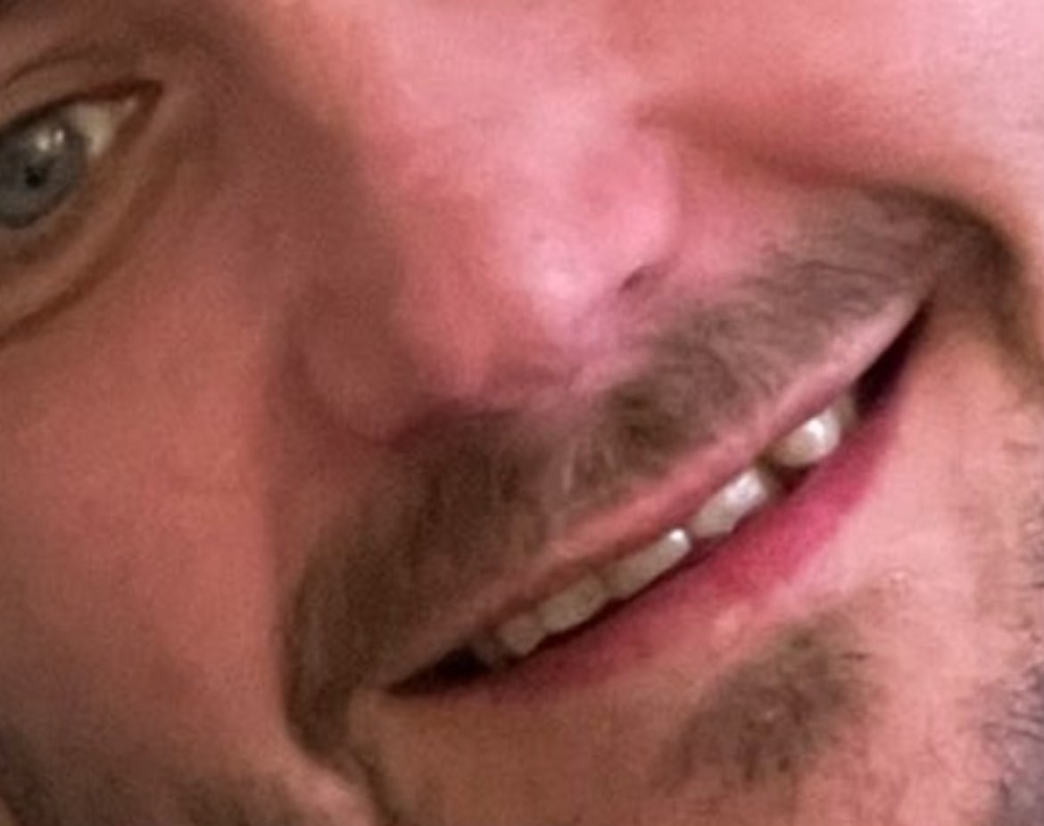 marksmusic1978's tweet photo. @CathersMcG @marcsmusic1977 These teeth 🦷 are a problem 🤢 https://t.co/NCD4tmm5ps
