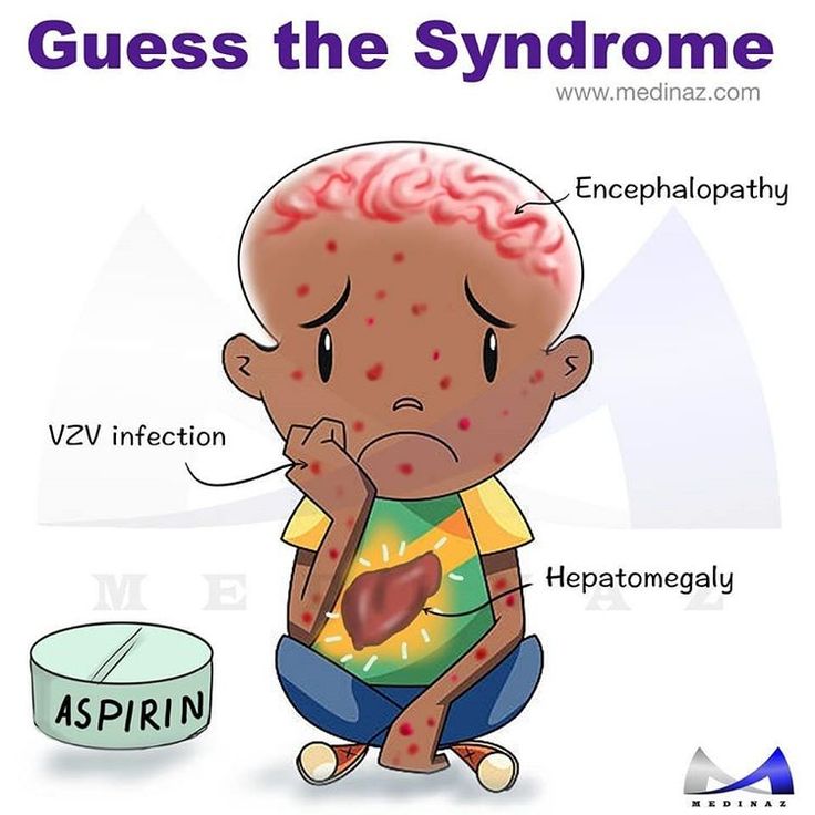 Neuromed_'s tweet photo. Guess the syndrome!!
#MedEd #MedX https://t.co/ufz9NDRd9B