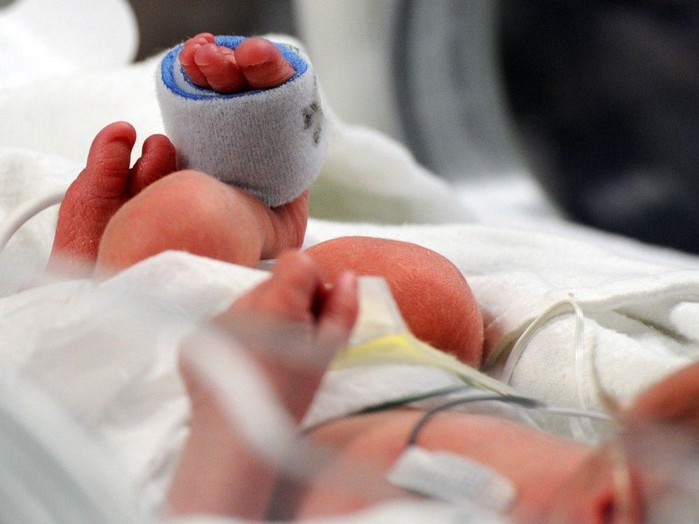 'Frail, underweight infants': Edmonton doctors say neonatal ICUs above safe capacity Read More: edmontonsun.com/news/local-new… #yeg #abhealth