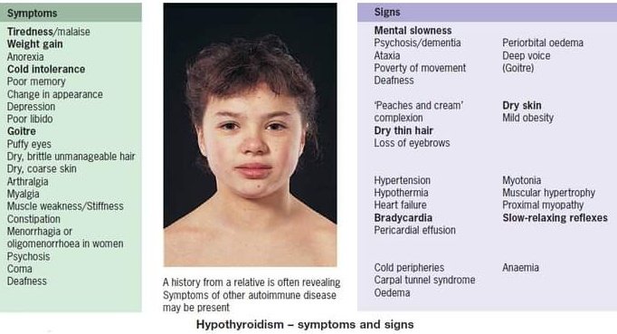 Signs & symptoms of 
Hypo & hyperthyroidism 

Subscribe 👇
youtube.com/@pgmedicine2023