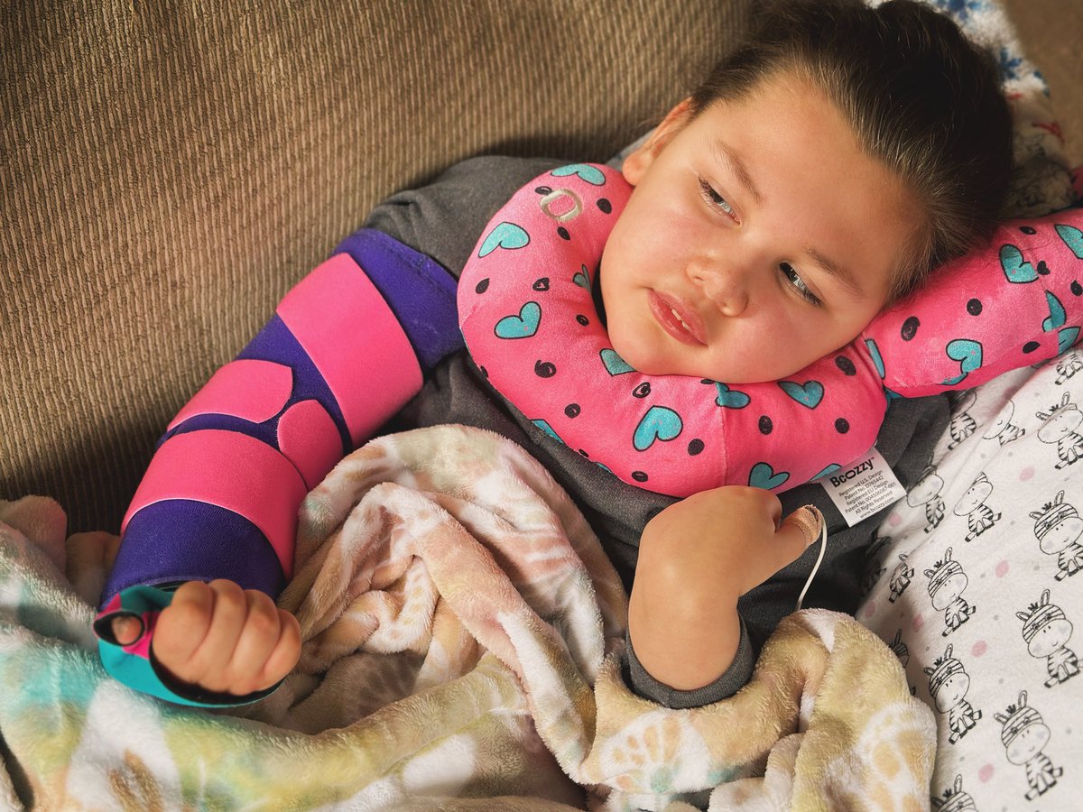 Dystonia (involuntary muscle contractions) is common for those with #BattenDisease. For Amelia, it often means clenched fists and curled-up arms. She wears a variety of braces to help stretch out her limbs and hopefully give her stiff muscles, tendons, and joints a break.