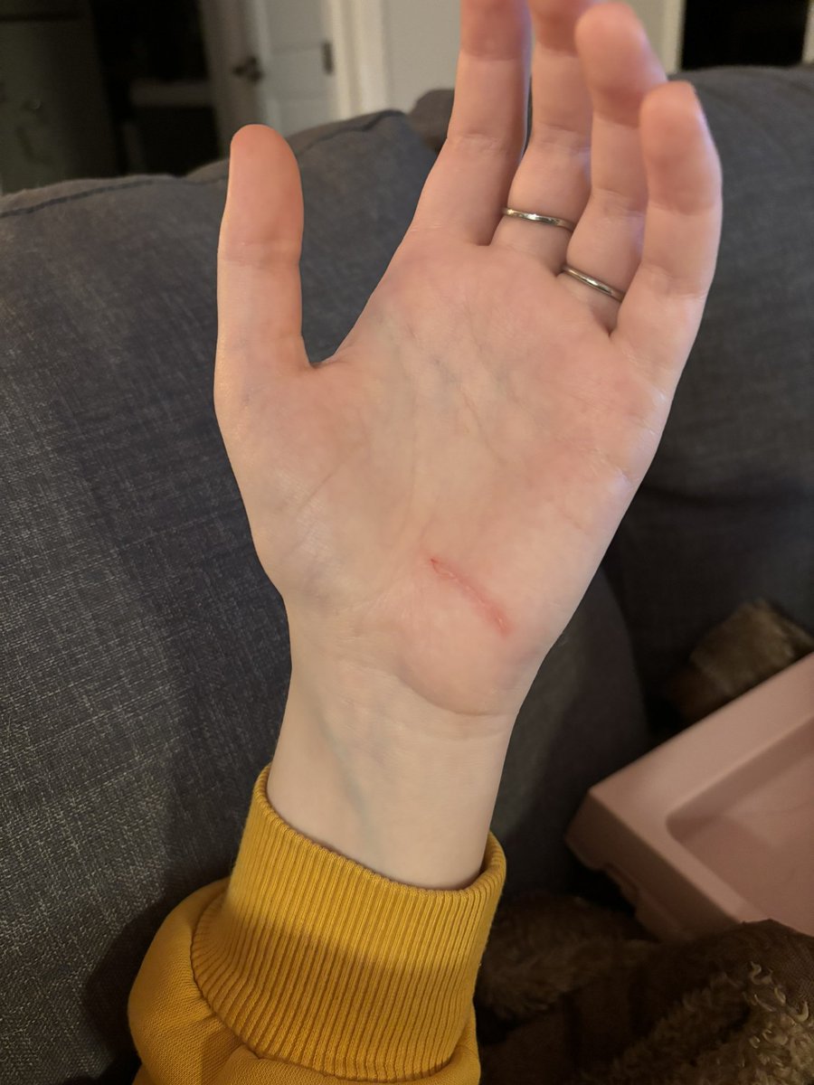 lorib96's tweet photo. My cat accidentally scratched me bc she got scared while I was holding her and I just feel like I’m Tris in Divergent https://t.co/pLDjRafFfQ