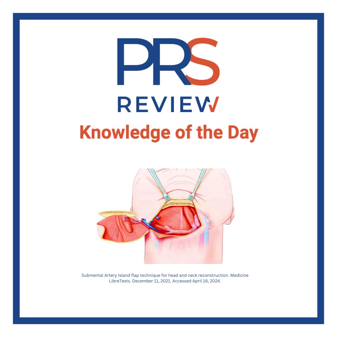 Submental artery island flap

#prsreview #microsurgery #headandneckreconstruction #headandneckcancer #cancer #surgicaloncology #ENT #plasticsurgery #reconstructivesurgery #surgicaleducation #medicaleducation #meded #plasticsurgeryresidency #plasticsurgeryfellowship #surgery