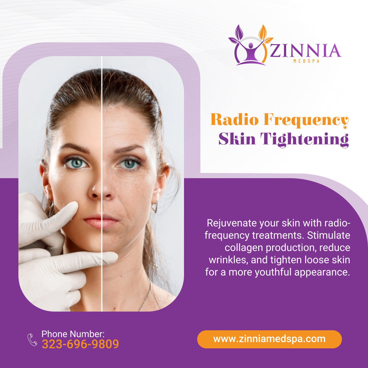 zinniamedspa's tweet photo. Renew your skin's youthfulness with our radio frequency treatments. Schedule your appointment today for firmer, tighter skin! 

#MedicalSpa #LosAngelesCA #SkinRenewal https://t.co/phZ28p60iP