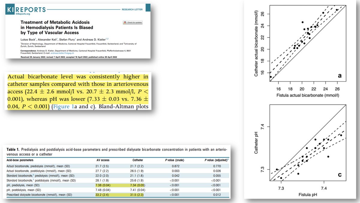 El HCO3 del baño lo prescribimos según el HCO3 prediálisis. ¿Individualizamos en función del acceso vascular? El HCO3 medido en fístula (sangre arterializada) es menor que el medido en catéter (sangre venosa). doi.org/10.1016/j.ekir… - 🤔🤔 @SENefrologia @SOMANEorg #Nefro_8_01