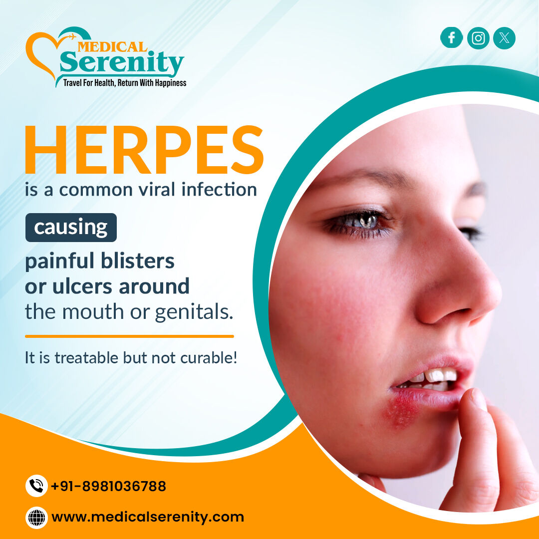 Herpes spreads from skin-to-skin contact. 🦠👄 Protection and sanitization are a must for prevention. Get immediate treatment if infected. Reach out to today! 

#herpes #herpesbacteria #viralinfection #ulcer #treatment #MedicalSerenity