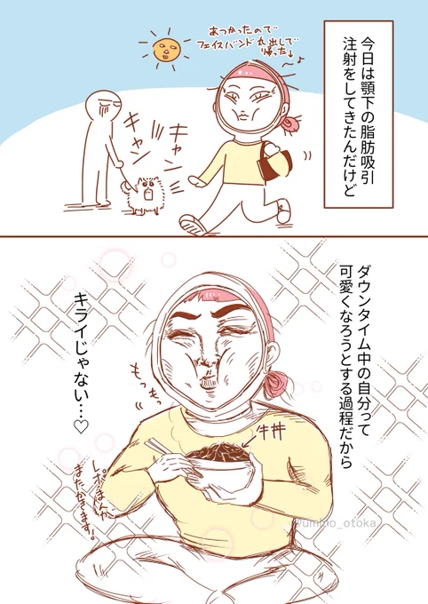 ダウンタイム中の自分は可愛くなろうと頑張ってる自分だから割と好き

#コミックエッセイ 
#漫画が読めるハッシュタグ 