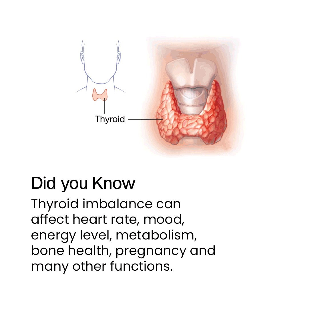 myHealthmeter's tweet photo. 🌿 Wellness Wednesday - Thyroid imbalance can impact various bodily functions, including heart rate, mood, energy levels, metabolism, bone health, and even pregnancy. Take proactive steps towards better thyroid health today! #WellnessWednesday #ThyroidHealth #PreventiveTips https://t.co/6rGbYCPQ9u