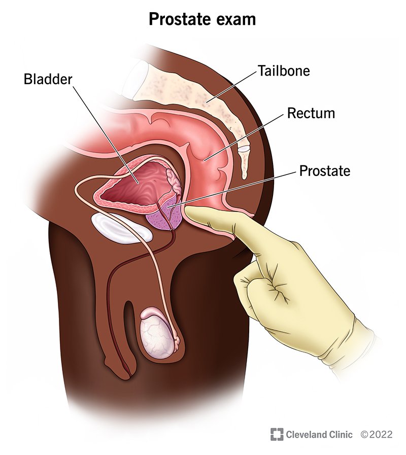 Thank you so much for this.

For those that don't understand.  There is an organ in your body called PROSTATE gland which functions in adding to your Semen amongst more.

The PROSTATE (see pic) is located close to Anus (just beside the rectum). 
PROSTATE Cancer still remains one