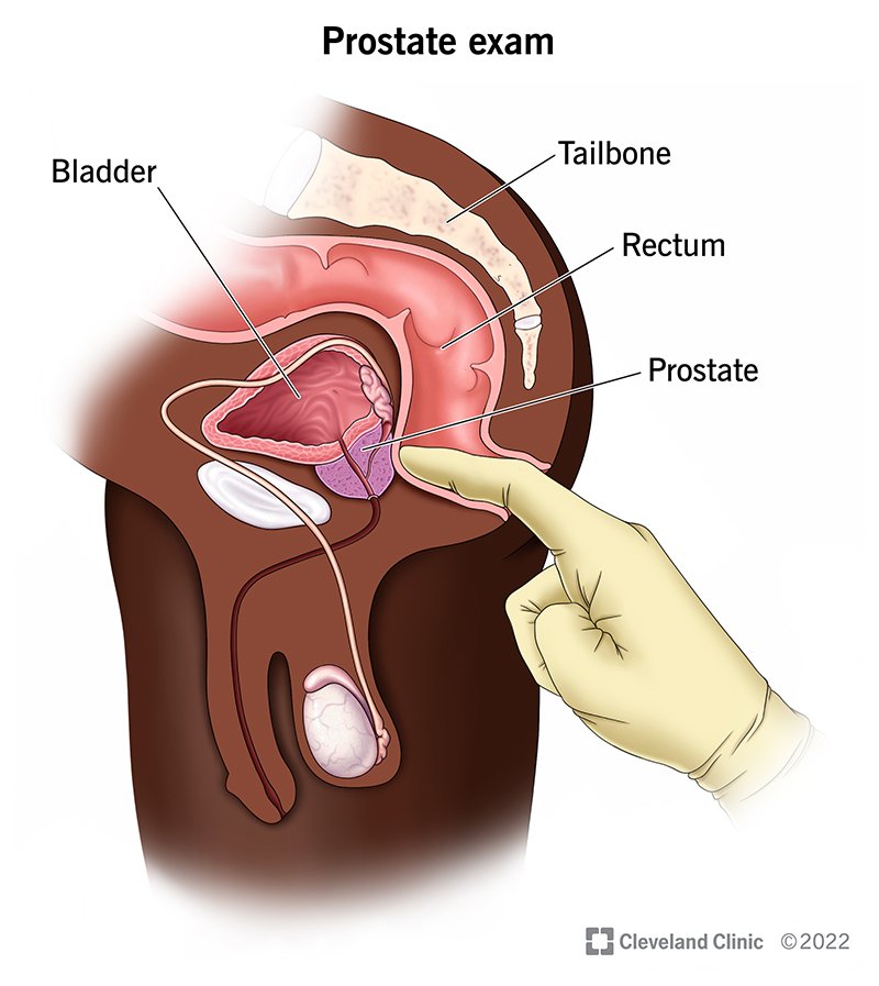 Thank you so much for this. For those that don't understand. There is an organ in your body called PROSTATE gland which functions in adding to your Semen amongst more. The PROSTATE (see pic) is located close to Anus (just beside the rectum). PROSTATE Cancer still remains one…