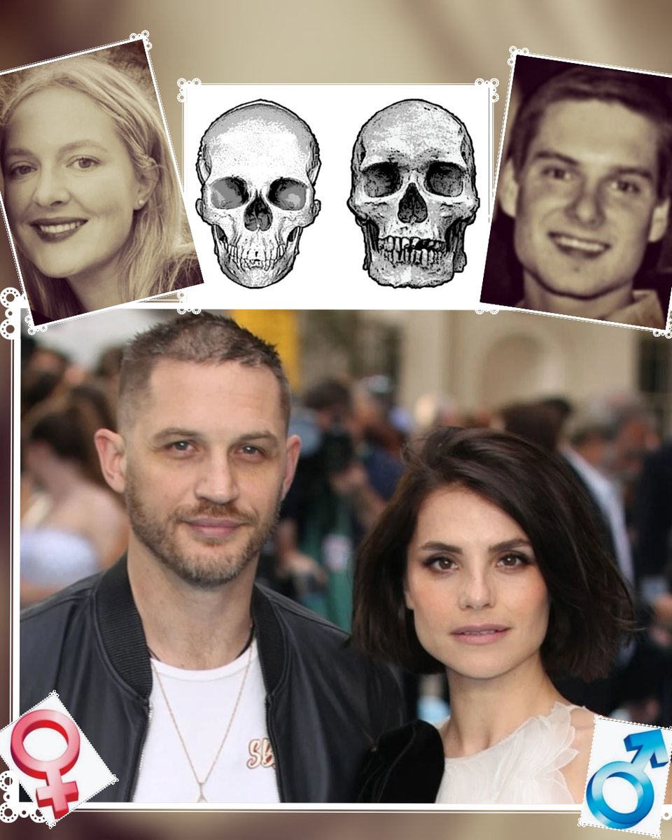 ELITE GENDER INVERSION
Openly trans MTF & FTM
with the wrong skulls
SQUARE VS OVAL 
Men have further apart eyes, wider cheekbones and jaws
.. 
 This is exactly what you see on all the celebs
#EGI