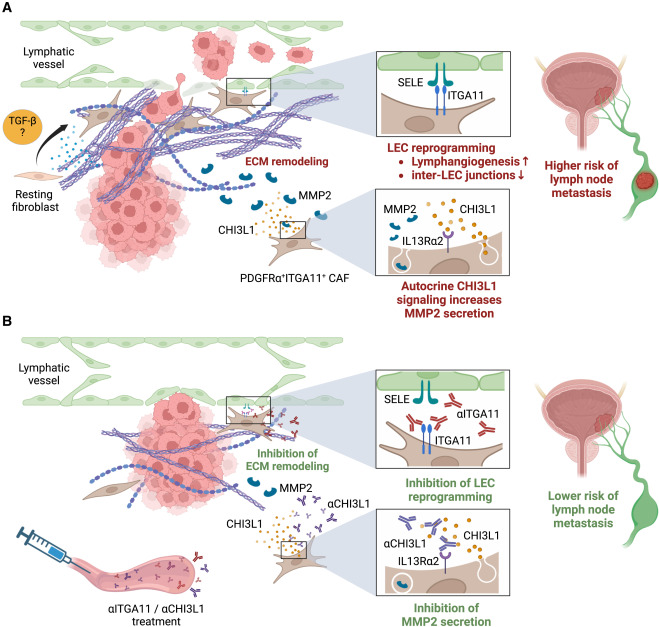 🔘 Study uncovers how cancer-associated fibroblasts interact with lymphatic endothelial cells to promote lymphovascular invasion in bladder cancer. These findings suggest potential new treatment targets 🎯

#BladderCancer @Cancer_Cell 

cell.com/cancer-cell/ab…