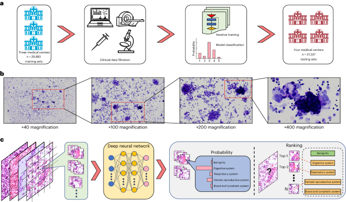 Prediction of tumor origin in cancers of unknown primary origin with cytology-based deep learning nature.com/articles/s4159… 📸 #CancerScreening #Oncology #Cancer