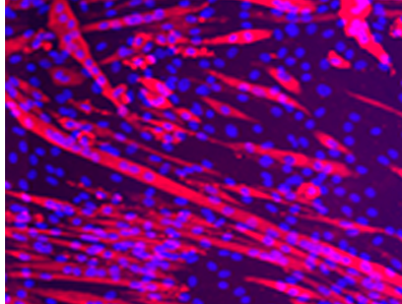 El tratamiento epigenético modula la diferenciación grasa y fibrosa de progenitores fibroadipogénicos en la degeneración muscular tras rotura de manguito rotador. Tesis doctoral de la Dra. Lara Gil.
boneandjoint.org.uk/Article/10.130…
<a href="/CIMA_unav/">Cima Universidad de Navarra</a> @gilgilmelgosaLa <a href="/rllombart/">rllombartb</a> <a href="/FelipeProsper/">Dr. Felipe Prósper</a>