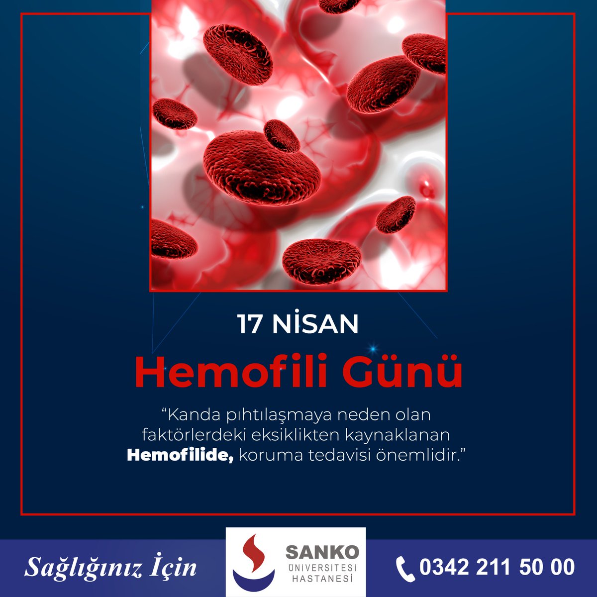 'Kanda pıhtılaşmaya neden olan faktörlerdeki eksiklikten kaynaklanan Hemofilide, koruma tedavisi önemlidir.'
#sankohastanesitr #sankoüniversitesihastanesi #hemofili #hemofiligünü