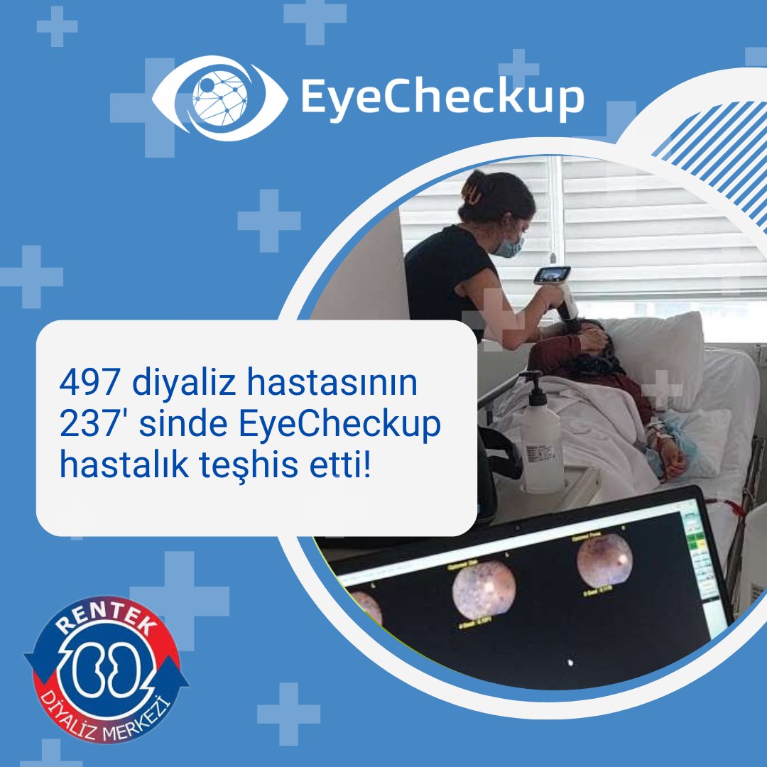 EyeCheckup - Early Diagnosis AI system (@eyecheckup) on Twitter photo Rentek Diyaliz Merkezinde yapmış olduğumuz evde hizmette 497 diyaliz hastası ziyaret edildi.
Hastaların 21'inde Diyabetik Makula Ödemi, 114'ünde Yaşa Bağlı Makula Dejenerasyonu, 21' inde Glokom, 81'inde Diyabetik Retinopati  teşhis edildi.
#glokom #sarınokta #diyabetikretinopati Rentek Diyaliz Merkezinde yapmış olduğumuz evde hizmette 497 diyaliz hastası ziyaret edildi.
Hastaların 21'inde Diyabetik Makula Ödemi, 114'ünde Yaşa Bağlı Makula Dejenerasyonu, 21' inde Glokom, 81'inde Diyabetik Retinopati  teşhis edildi.
#glokom #sarınokta #diyabetikretinopati