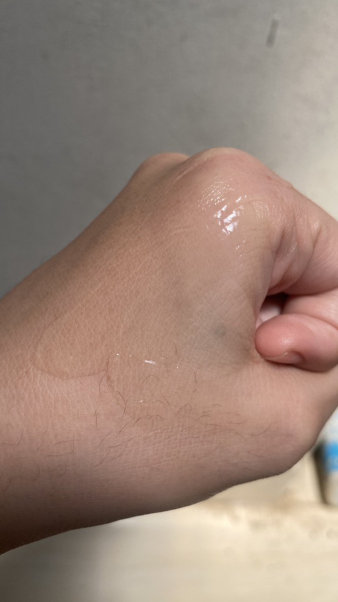 diraadevv's tweet photo. Pas di apply di muka emang gel bgt si, ada sensasi dinginnya gitu tp afternya malah bikin lembap banget ke kulit😮 kirain bakal yang kayak bikin kering gitu (btw, aku gaterlalu cocok sama yg basenya gel. tp surprisingly pake ini cocok bgt!)

after menyerap juga dia langsung matte https://t.co/IAWV1ARkPZ