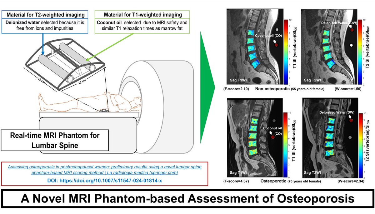 #RadiolMed 📢New MRI phantom assesses osteoporosis & fractures with F-score & W-score, outperforming DXA-aBMD 🆓rdcu.be/dEZRk #MRI #OsteoporosisDetection @_sirm ▶️More journal contents at rb.gy/sodn9w