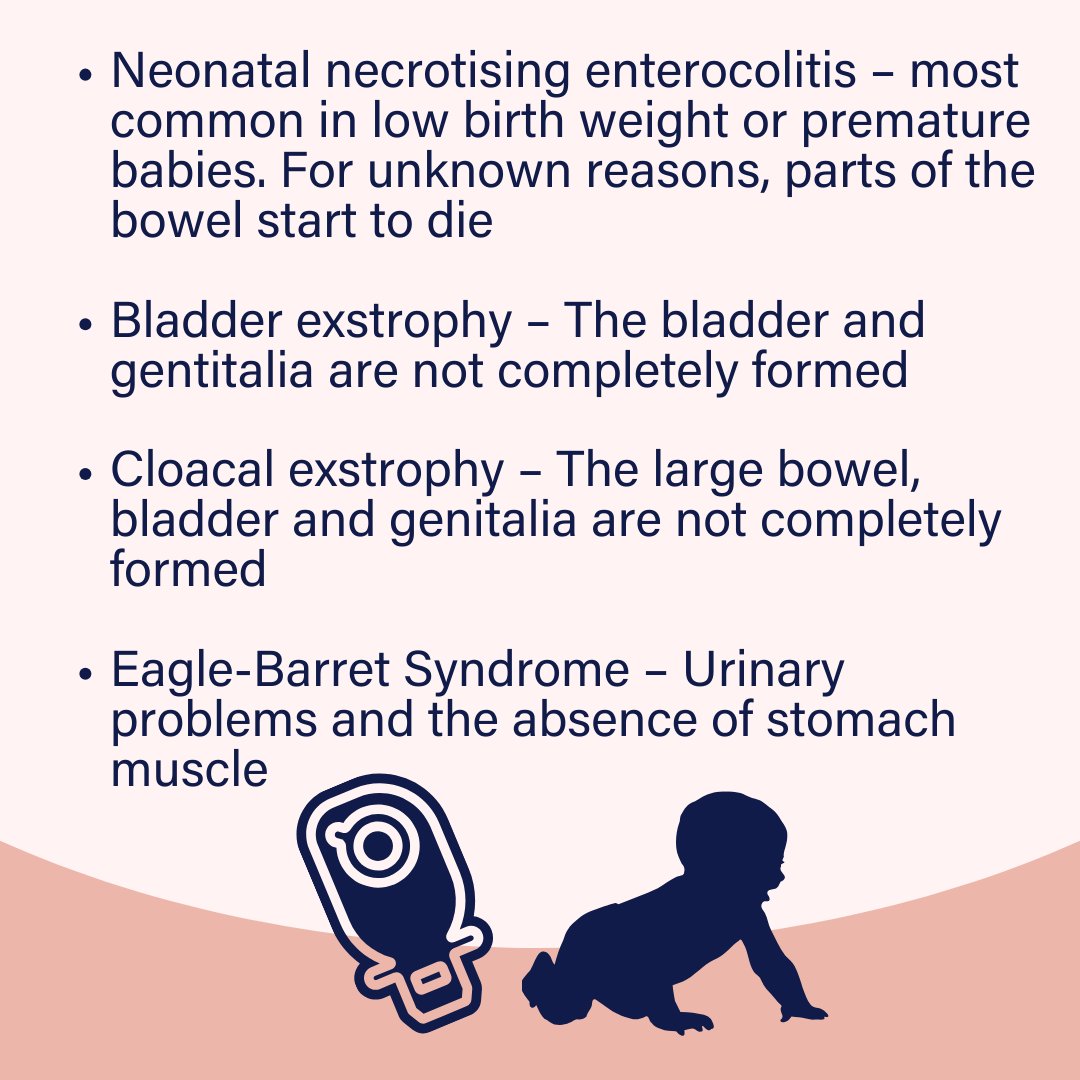 Why might babies and children need stomas?🤔 If you have a child with a stoma, you're not alone in this journey, and there are resources available to help you navigate this chapter in your child's health.💜 Source: oakmed.co.uk/help-advice/ad…