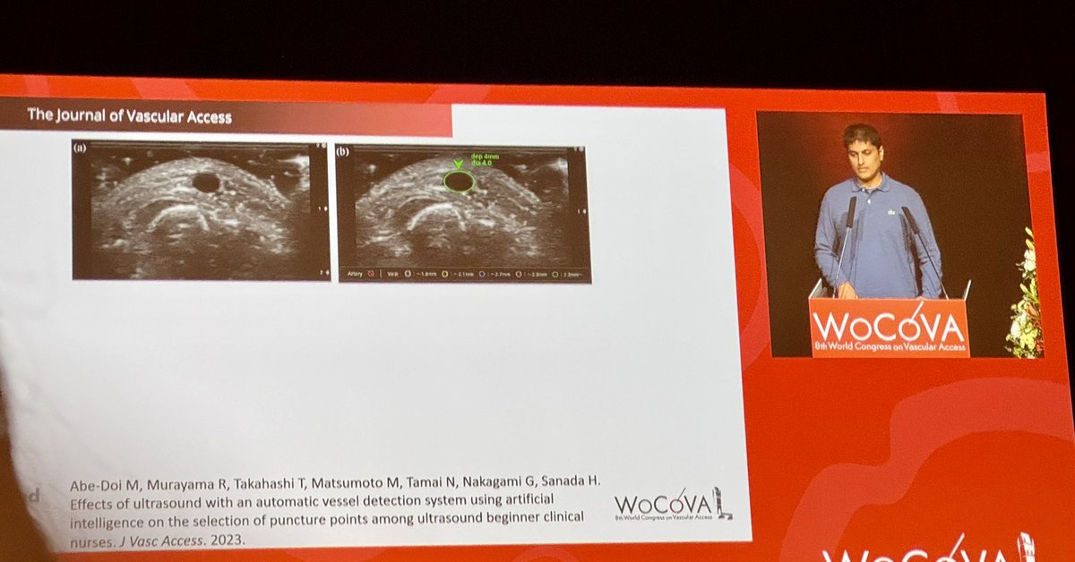 Ultrasound + AI = greatest impact vein assessment #wocova24 @WoCoVA @NIVAS_tweets