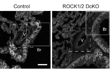FEBSOpenBio's tweet photo. Conditional deficiency of Rho-associated kinases disrupts endothelial cell junctions and impairs respiratory function in adult mice
🔗https://t.co/meHmCPwH5l
#Endothelialcell #CellJunctions #celladhesion https://t.co/5iObJAxOFq