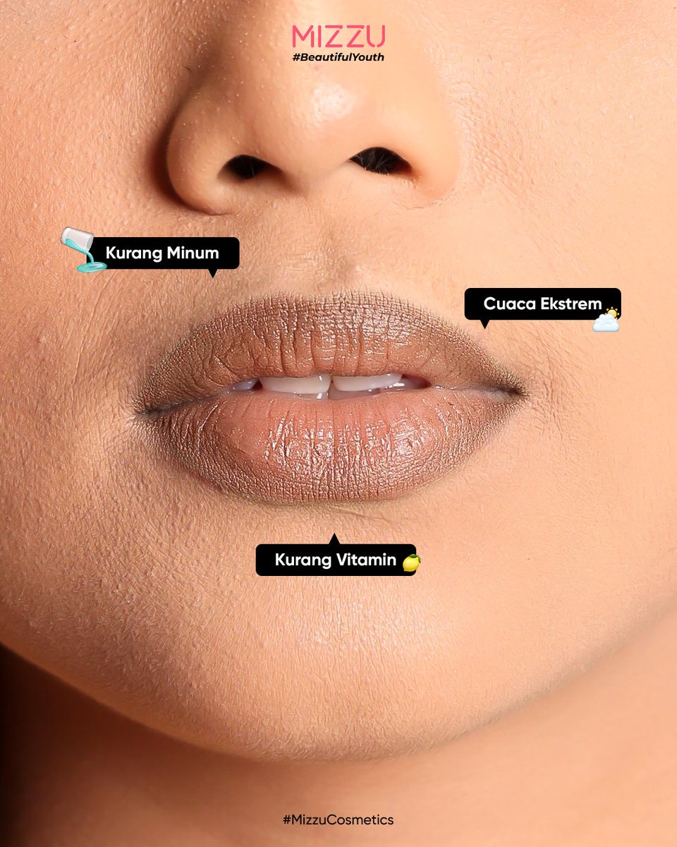 MizzuCosmetics's tweet image. Transform your lips from dry to fresh moisturized!🍒✨

Cuaca ekstrim, kurang minum, dan kurang vitamin bisa bikin bibir kamu makin kering dan gelap, makanya kamu perlu Gotchu Lipstain yang bisa bantu bibir kamu jadi tampak fresh dan sehat!💗 Buruan cobainn!!!

#lipstain