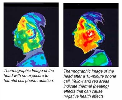 the EMF radition levels the retroid pocket 2s shoots out HOLY SHIT my entire face is throbbing