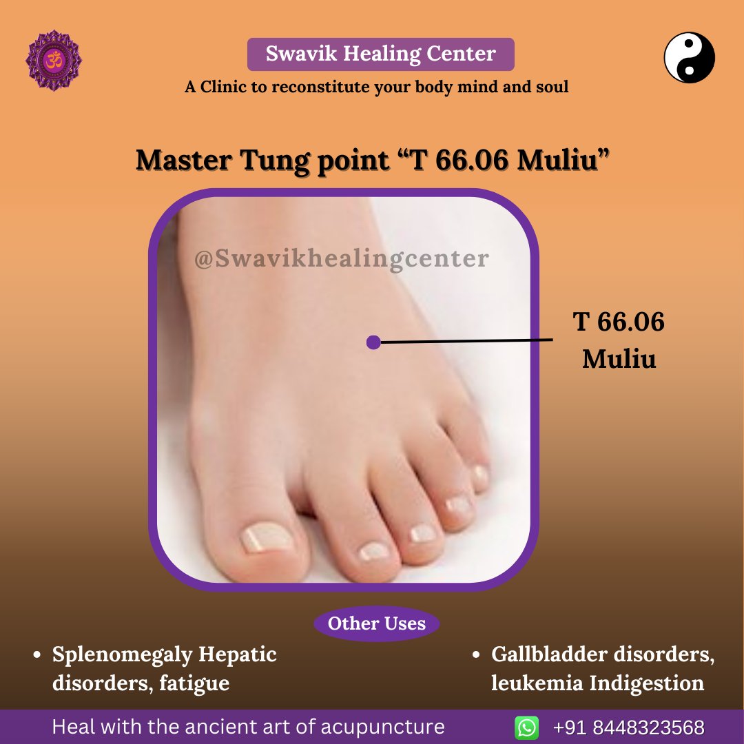 ☯ Master Tung point “T 66.06 Muliu”

☯ Fatigue is a feeling of constant exhaustion, burnout, or lack of energy.

#acupunctur #acupunctur #acupressurepoints #fatigue #fatiguepants #leukemia #leukemiawarrior #gallbladder #indigestion #cuppingmassage