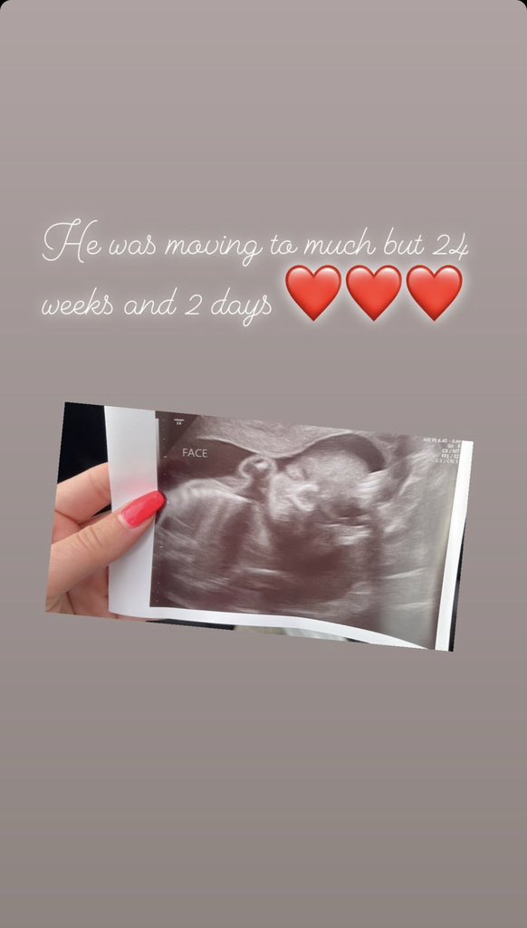 whitee (@momtojuliann) on Twitter photo 