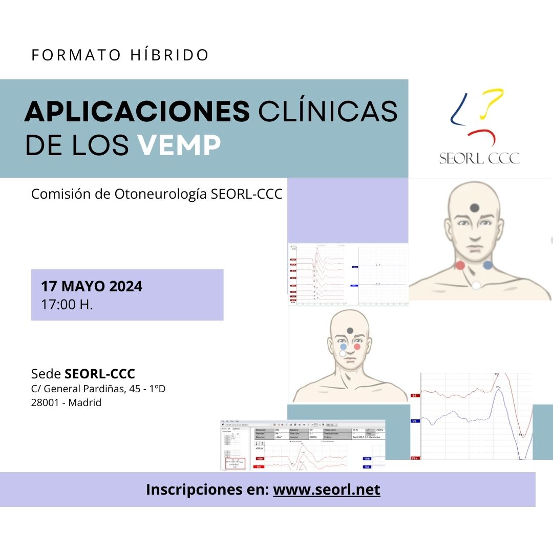 📢¡Save the date! Aplicaciones Clínicas de los VEMP 📅17 de mayo 17:00 horas 📍Sede SEORL-CCC 💻Formato híbrido Inscríbete y consulta el programa aquí👇 seorl.net/comisiones/com…