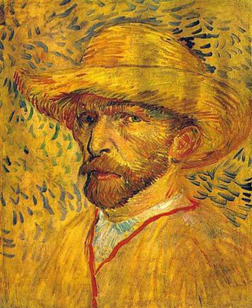 L'ossessione per il giallo di Van Gogh potrebbe esser dovuto all'assunzione di un estratto di digitale usato per curare l'epilessia:questa pianta contiene digossina,un veleno che può portare alla xantopsia,che ha come esito il crearsi di un tono giallo su tutto ciò che si osserva