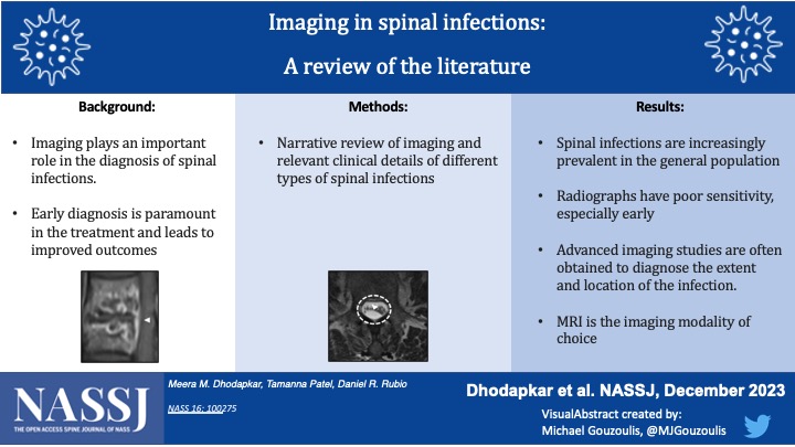 NASSJ (@nassjournal) on Twitter photo Spinal infections are increasingly prevalent in the general population, and MRI is the imaging modality of choice for diagnosis <a href="/MeeraDhodapkar/">Meera Dhodapkar</a> <a href="/tpatel514/">Tamanna Patel, MD</a> <a href="/drubiomd_spine/">Daniel Robert Rubio</a> <a href="/NASSspine/">NASS</a> @ElsOrthopaedics #orthotwitter Spinal infections are increasingly prevalent in the general population, and MRI is the imaging modality of choice for diagnosis <a href="/MeeraDhodapkar/">Meera Dhodapkar</a> <a href="/tpatel514/">Tamanna Patel, MD</a> <a href="/drubiomd_spine/">Daniel Robert Rubio</a> <a href="/NASSspine/">NASS</a> @ElsOrthopaedics #orthotwitter