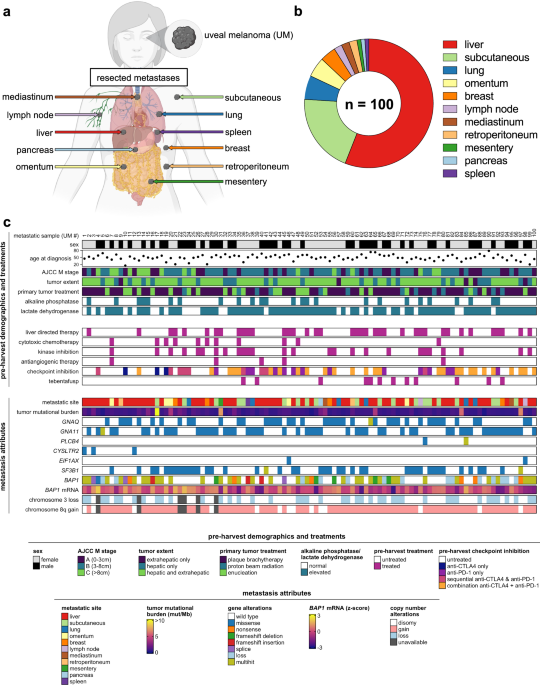 Uveal melanoma immunogenomics predict immunotherapy resistance and susceptibility nature.com/articles/s4146… 🔪 #SurgicalOncology #SurgOnc #Oncology #Cancer