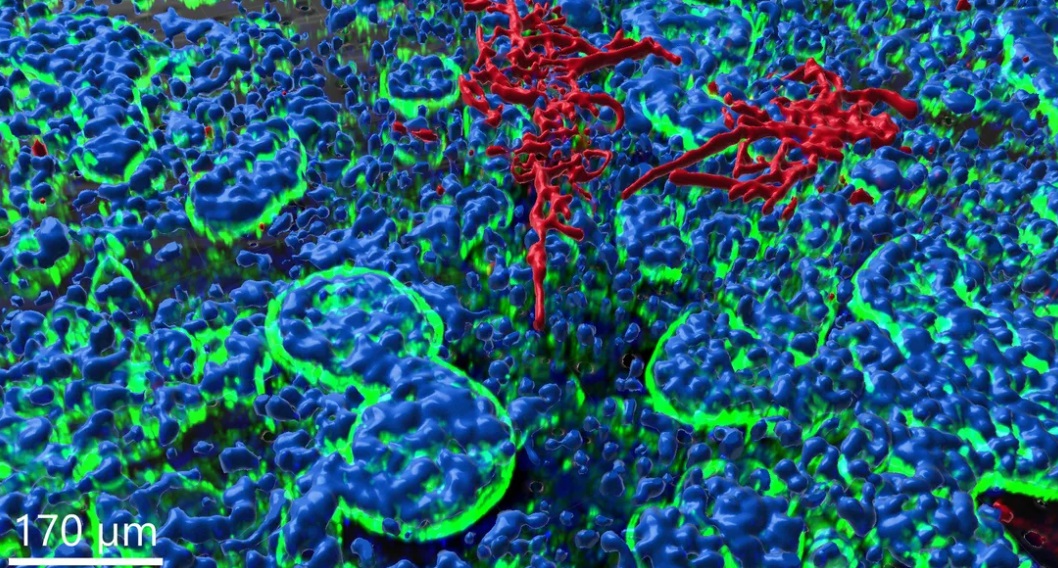 Exciting collaboration between science, clinic and start-up with promising results! <a href="/Dynamic42_Jena/">Dynamic42 GmbH</a>  <a href="/LeibnizHKI/">Leibniz-HKI</a> and <a href="/uniklinik_jena/">Uniklinik Jena</a> 

Read  all about it here👉 bionity.com/en/news/118302… 

#amr #antifungal #antibioticreistance #antimicrobialresistance