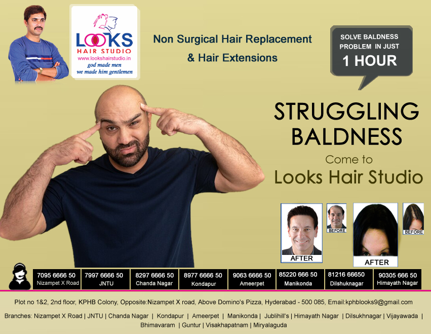 STRUGGLING BALDNESS
Come to Looks Hair Studio
100% Natural Looking, No Side effects. Nizampet X Road-7095666650, JNTU-7997666650 Kondapur- 8977666650, Ameerpet-9063666650, ChandaNagar-8297666650 #nonsurgicalhairreplacement #hairreplacement #hairpatch #hairfixing #hairsystem #hair