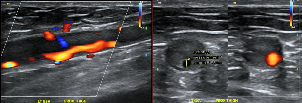 Michael Cumming tweet media