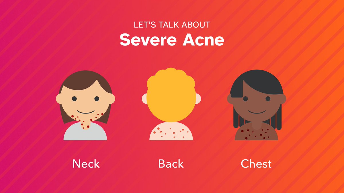 We take into account over 8,500 genetic markers to estimate your likelihood of having severe acne. Learn more with the Severe Acne report (Powered by 23andMe Research), part of the 23andMe+ Premium membership, here: 23and.me/3PLq1To