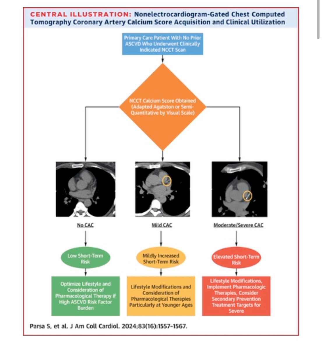 What do you do with “incidental” CAC found on chest CT? Great opportunity for this emerging tool in #cvprevention jacc.org/doi/10.1016/j.… @DrPJoshi @ParsaShyon @AnnMarieNavar @dranandrohatgi @SuhnyAbbara @utswheart