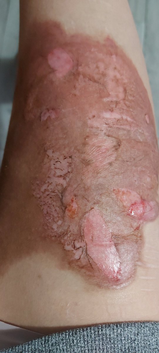 SliceyBear's tweet photo. It's so gross https://t.co/fOlE7kE5PE