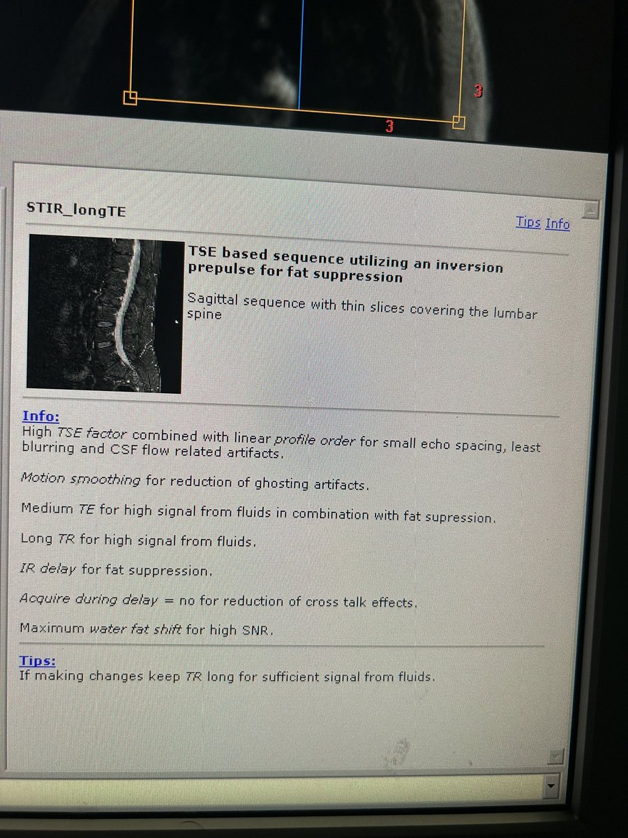 Philips MRI ☢️🌟.