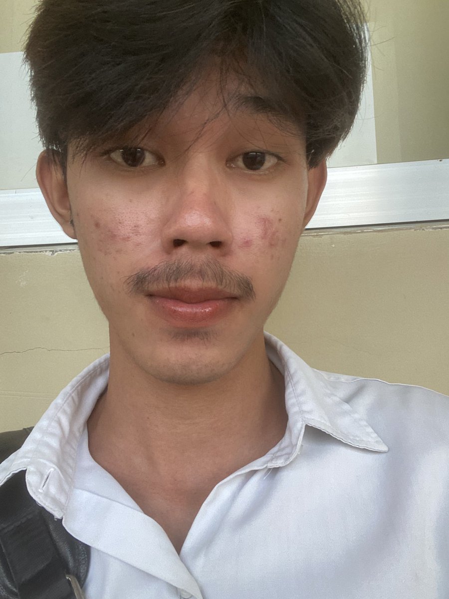 NETH33822726's tweet image. 👾👾