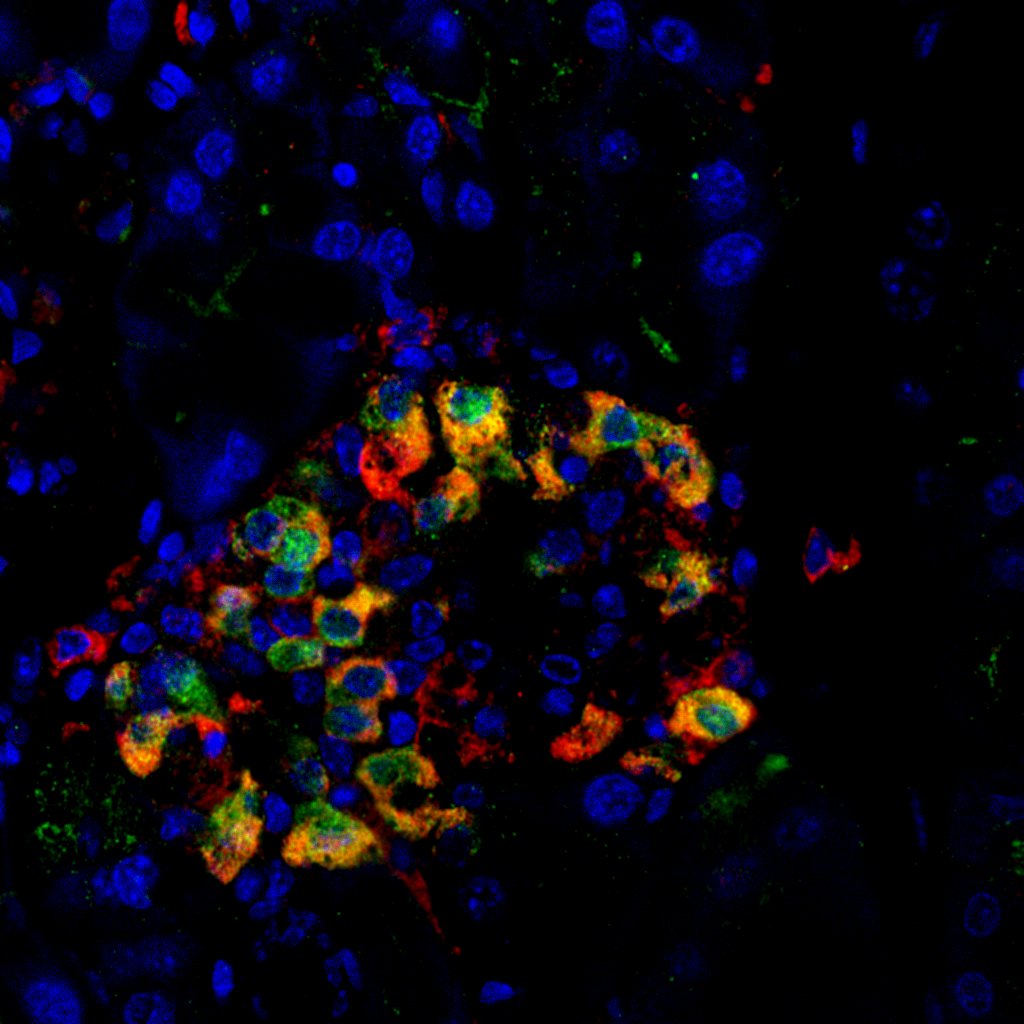 RSeguiLab's tweet photo. We've just launched a new Research Topic on "Advances in β-cell Development &amp; Regeneration" in @FrontiersIn! Co-edited by @TxellRovira, @GittesGeorge and myself, we are now receiving manuscript proposals. Explore and contribute your insights!

More info: https://t.co/FW7C5AIut8 https://t.co/MzSkoDR8bE