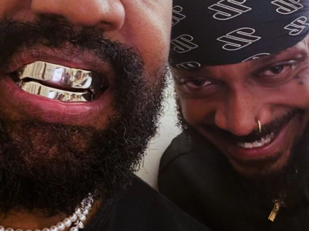 Ye’s New Titanium Teeth: Kanye West’s $850,000 Smile Makeover pittstdentalcentre.com.au/yes-new-titani… #yeteeth #ye #kanyewest #biancacensori #titaniumteeth #iamtitanium #smilemakeover