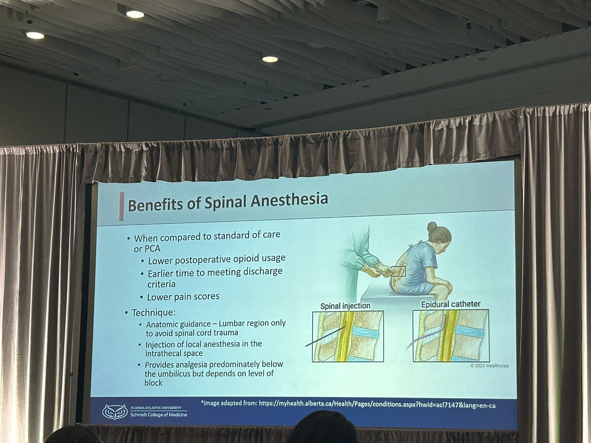 Congratulations @DouradoJMD on your podium presentation this morning #SAGES2024 @SAGES_Updates @CleveClinicFL @SWexner