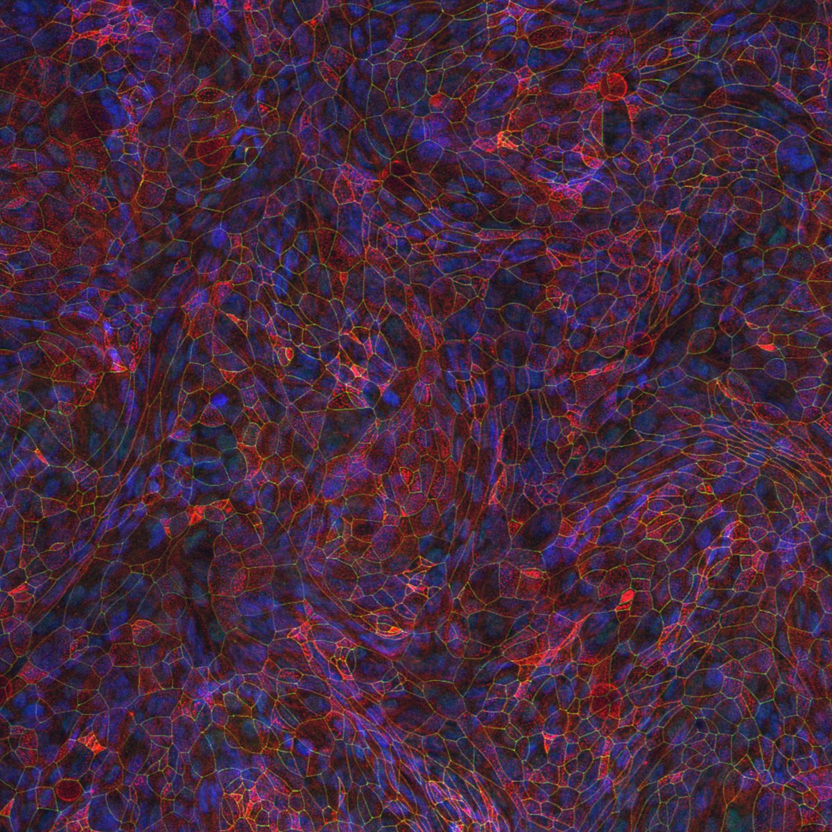 Intestinal_Cell's tweet photo. #ICYMI, @STEMCELLTech's annual #StemCellfie contest is still accepting submissions until 11:59 am PDT on April 19th! Submit your best #cellfie: https://t.co/8idcDOnqzY
Take a look at these stunning #IntestinalCell images submitted last year! #SciArt ๐จ๐ธ https://t.co/oD6OkMaAjk