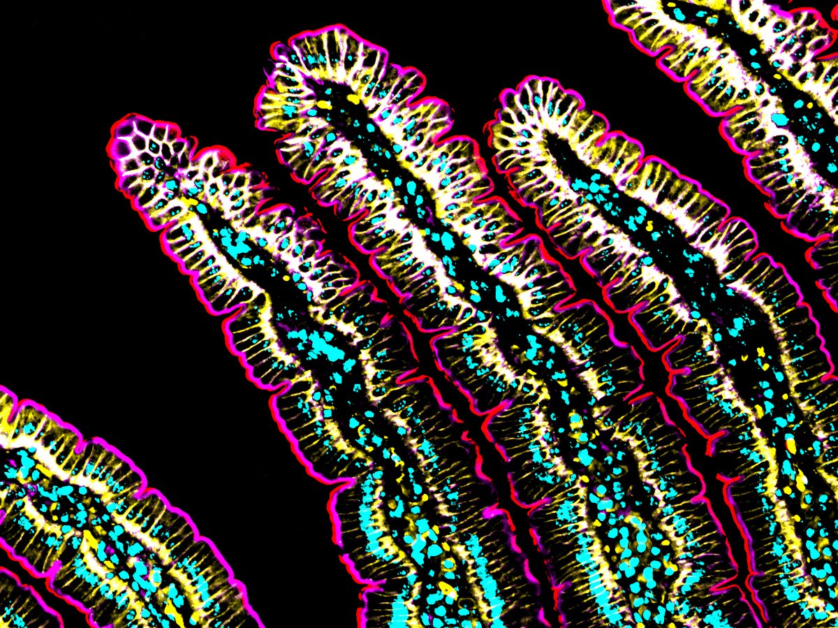 Intestinal_Cell's tweet photo. #ICYMI, @STEMCELLTech's annual #StemCellfie contest is still accepting submissions until 11:59 am PDT on April 19th! Submit your best #cellfie: https://t.co/8idcDOnqzY
Take a look at these stunning #IntestinalCell images submitted last year! #SciArt ๐จ๐ธ https://t.co/oD6OkMaAjk