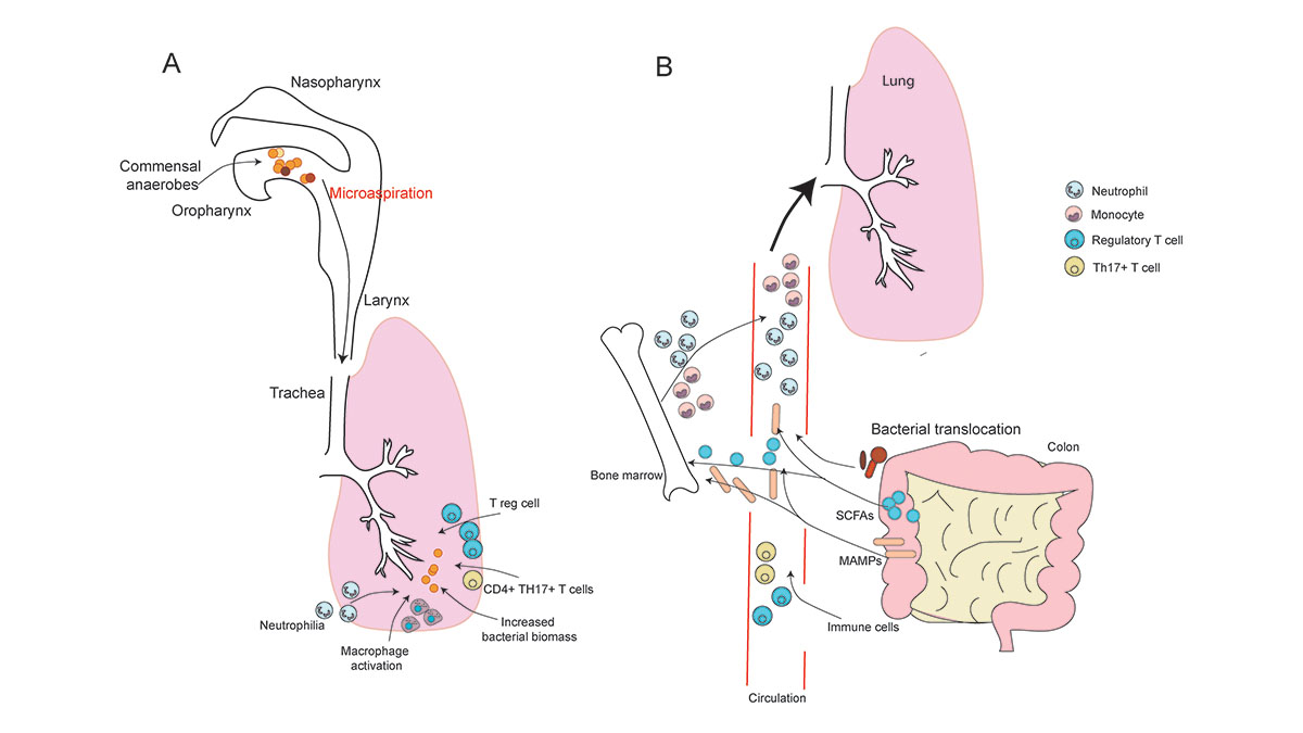 This #BriefReview discusses host-#microbiome interactions and the impact on #airway #lung disease. Check it out! DYK #ReadTheJI #immunology ➡️ ow.ly/xpZ050Rgw70